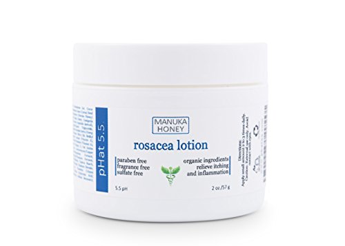 Rosacea Cream - Organic Treatment Moisturizer with Coconut Oil, Manuka Honey, Aloe Vera, Shea Butter, Plumeria, Hempseed & Olive Oil for Redness Relief, Inflammation & Anti Acne (2 oz) by pHat 5.5