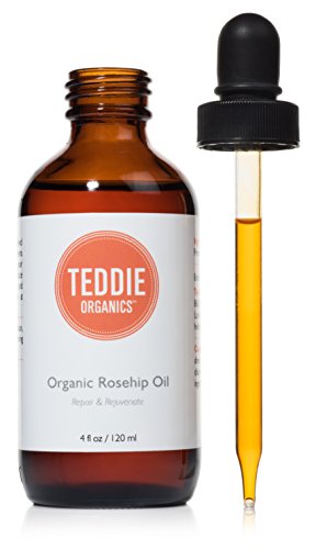 Organic Rosehip Oil – 100% Pure Unrefined Cold Pressed Rosehip Seed Oil - Best Moisturizer for Face, Hair - Great for Fine Lines, Wrinkles, Acne Scars, Sun Damage, Stretch Marks, Eczema, Psoriasis