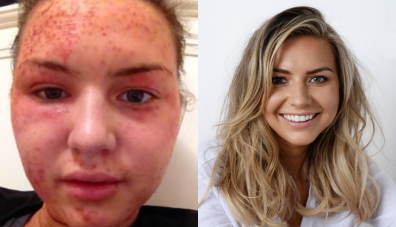 Camille-knowles-before-and-after-1.png