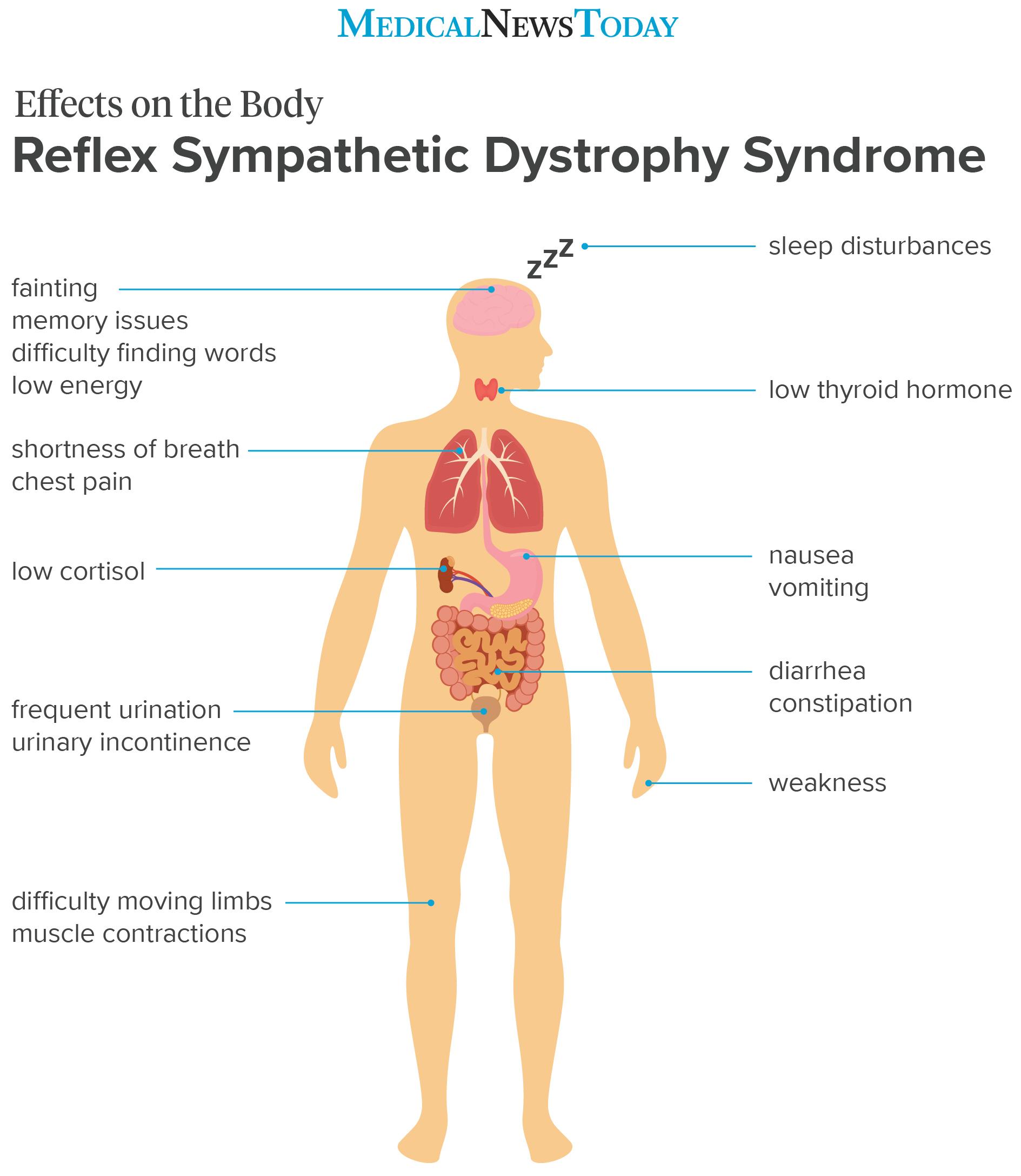 an infographic showing the effects on the body of RSD
